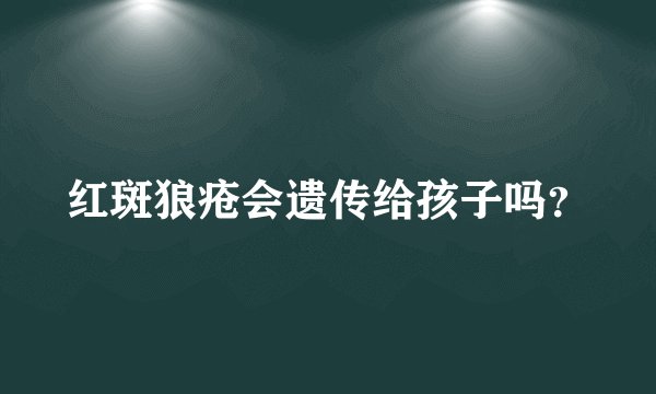 红斑狼疮会遗传给孩子吗？