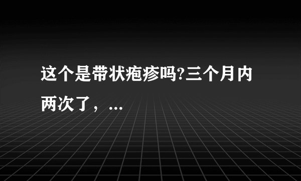 这个是带状疱疹吗?三个月内两次了，...