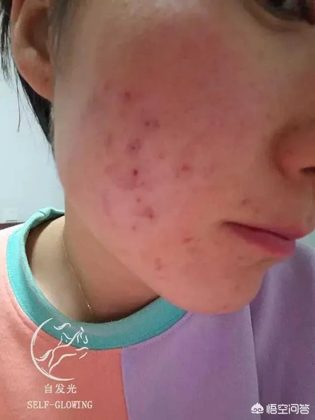 女生为了变好看变漂亮能有多拼？