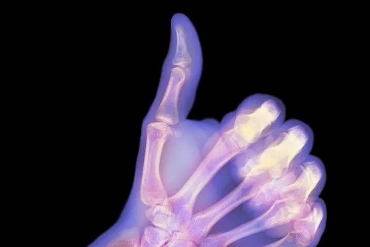 大拇指骨头图片大全