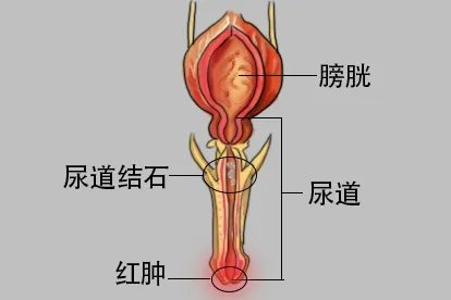 尿道口红肿是什么原因图片