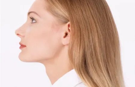 激光去疤痕多少钱整形