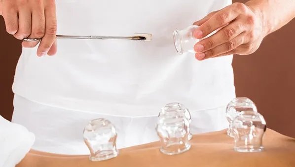 拔罐能去除体内湿气吗