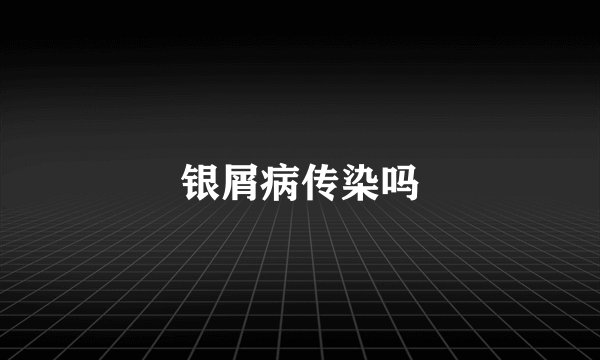银屑病传染吗