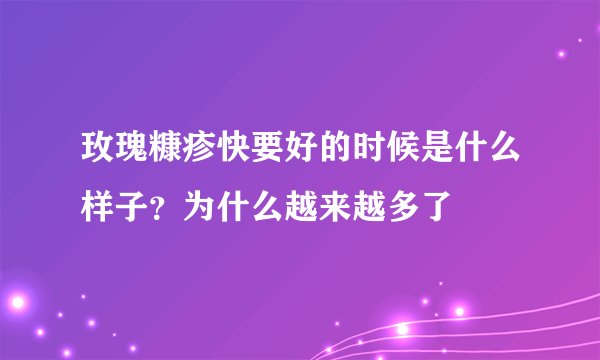 玫瑰糠疹快要好的时候是什么样子？为什么越来越多了