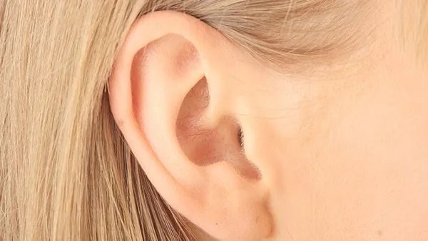 什么是耳前瘘管