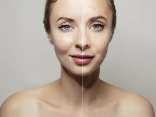 皮肤暗沉的原因有哪些