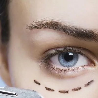 尿酸高是怎么回事