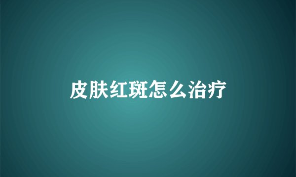 皮肤红斑怎么治疗