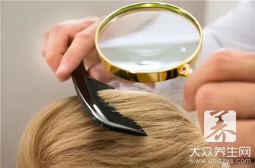 头皮屑多且大块还结痂怎么办