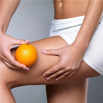 腿上的紫纹怎么消除?