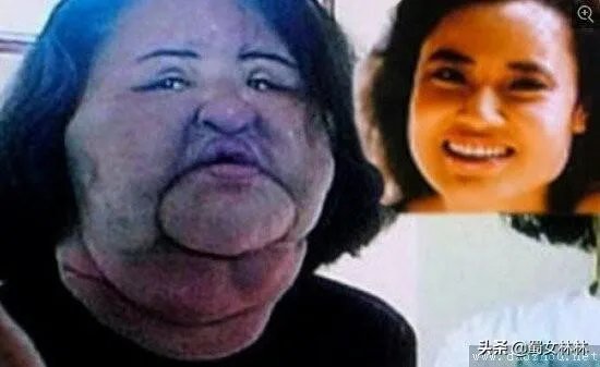 女生为了变好看变漂亮能有多拼？