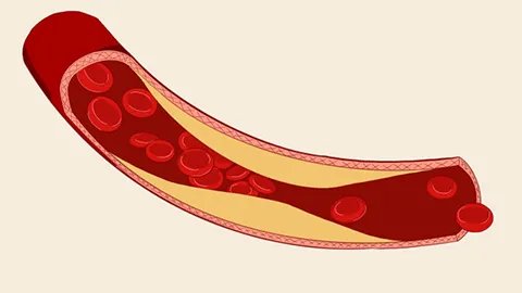 血压的正常范围是多少