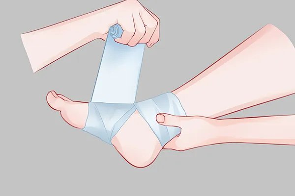 肌肉拉伤怎么快速恢复