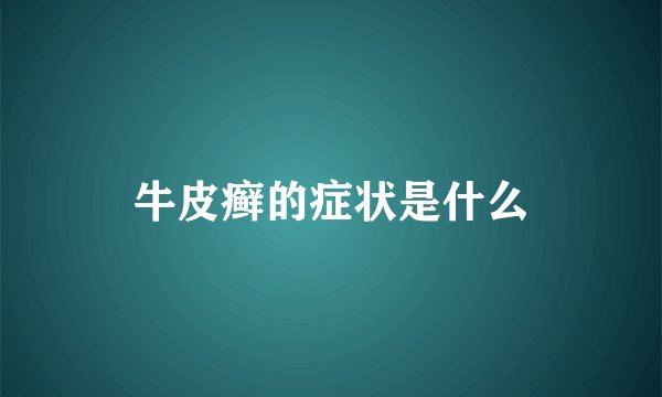 牛皮癣的症状是什么