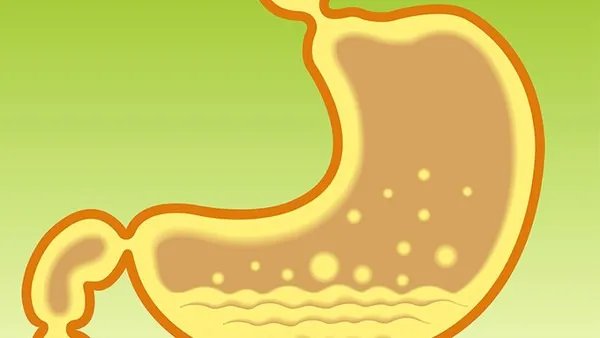 胃癌的早期症状