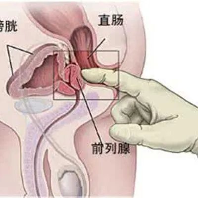 阴颈根部疼痛怎么回事?