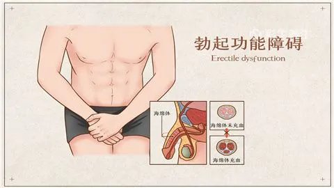 阳痿什么症状