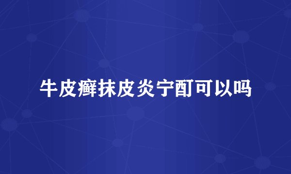 牛皮癣抹皮炎宁酊可以吗
