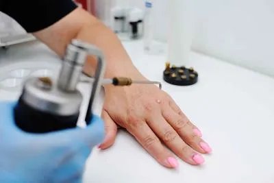 兰美抒治疗灰指甲的效果 患有灰指甲之后的注意事项