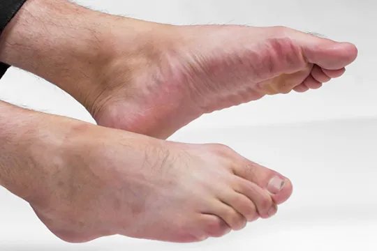 脚底板疼是怎么回事