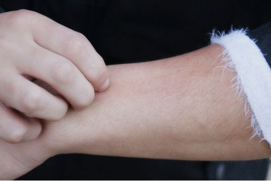 全身痒是怎么回事