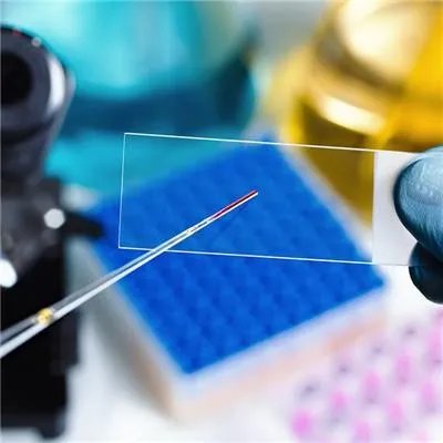 铁蛋白高是怎么回事