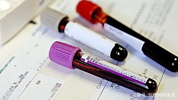 血小板减少的症状有哪些