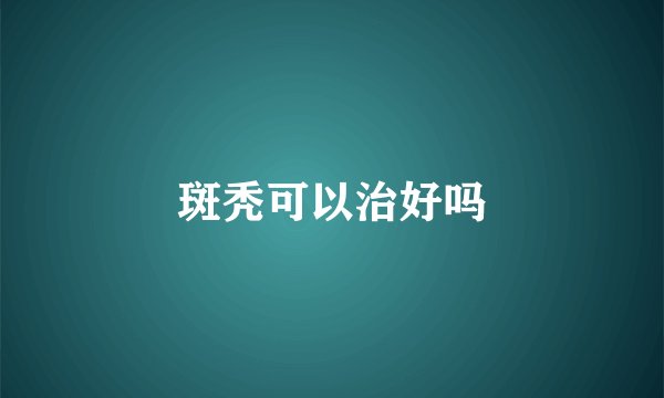 斑秃可以治好吗