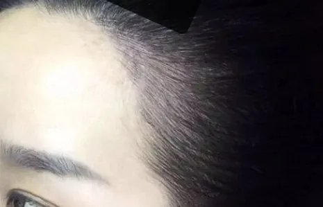 重庆联合丽格美容医院丰苹果肌怎么样?项目价格一览