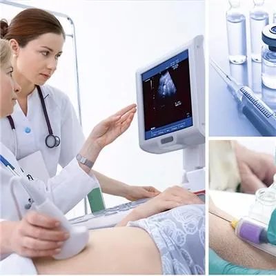 畸胎瘤是怎么形成的