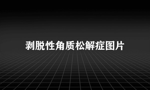 剥脱性角质松解症图片