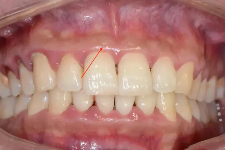牙槽骨是哪个部位