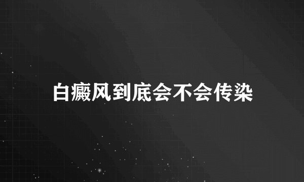 白癜风到底会不会传染