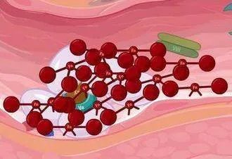 血小板减少的症状有哪些