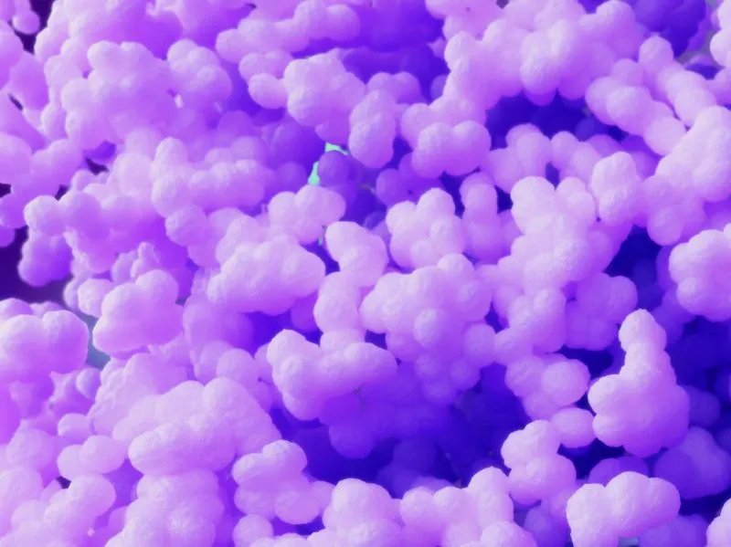 化脓性链球菌感染的症状有哪些