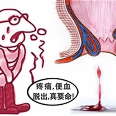 大便干燥是什么原因