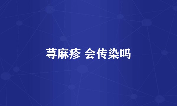 荨麻疹 会传染吗