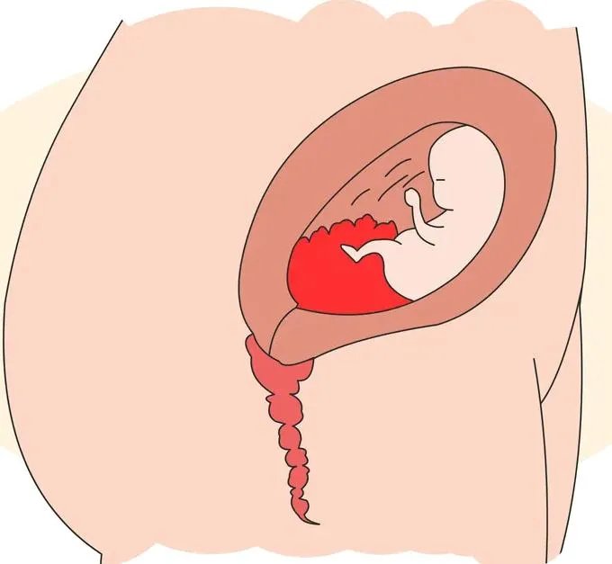 第三代试管女性受罪吗-郴州哪家医院可以做三代试管婴儿？ 具体的成功率和费用是多少？