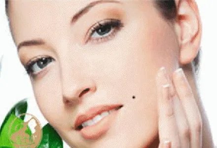 激光点痣多少钱