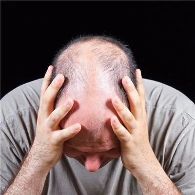 如何防止脱发
