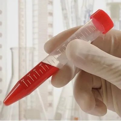 乙肝转阴的方法