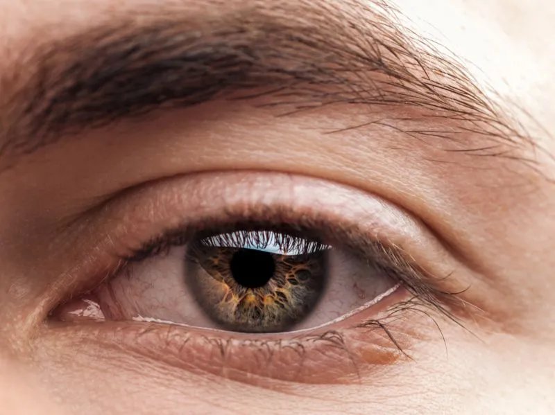 眼睛凹陷怎么办