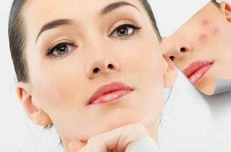 打玻尿酸有什么用